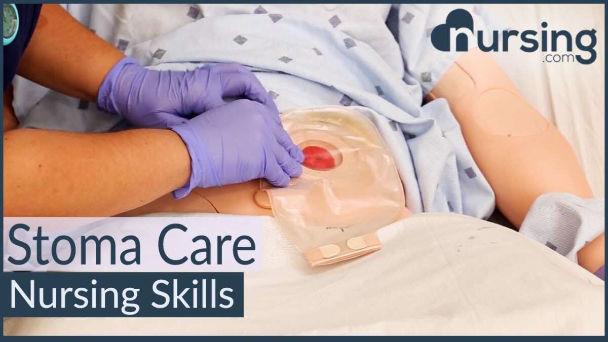 How To Change A Colostomy Bag